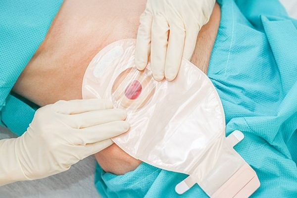 Customized Care